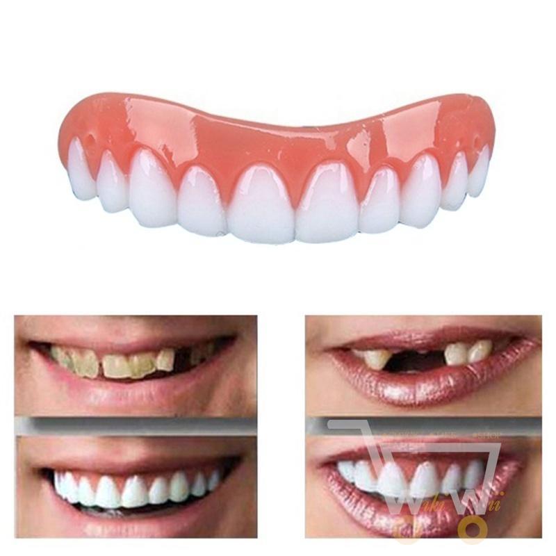 The Perfect Smile Veneers - WikiWii