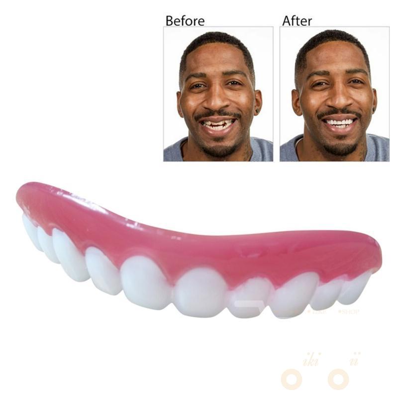 The Perfect Smile Veneers - WikiWii