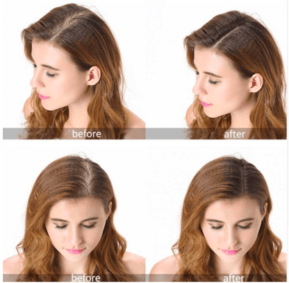 Home Hair Growth - Laser Device - WikiWii