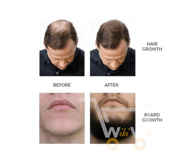 ORGANIC HAIR GROWTH ESSENCE - WikiWii