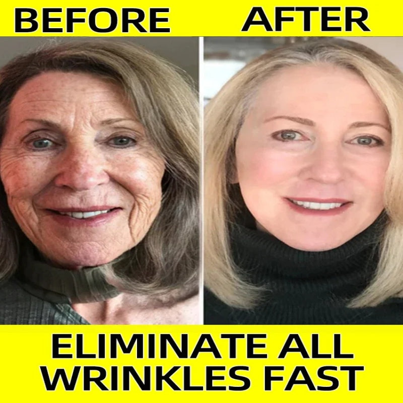 🔥 You Just Unlocked Your Discount ! Natural Anti-Wrinkle Serum