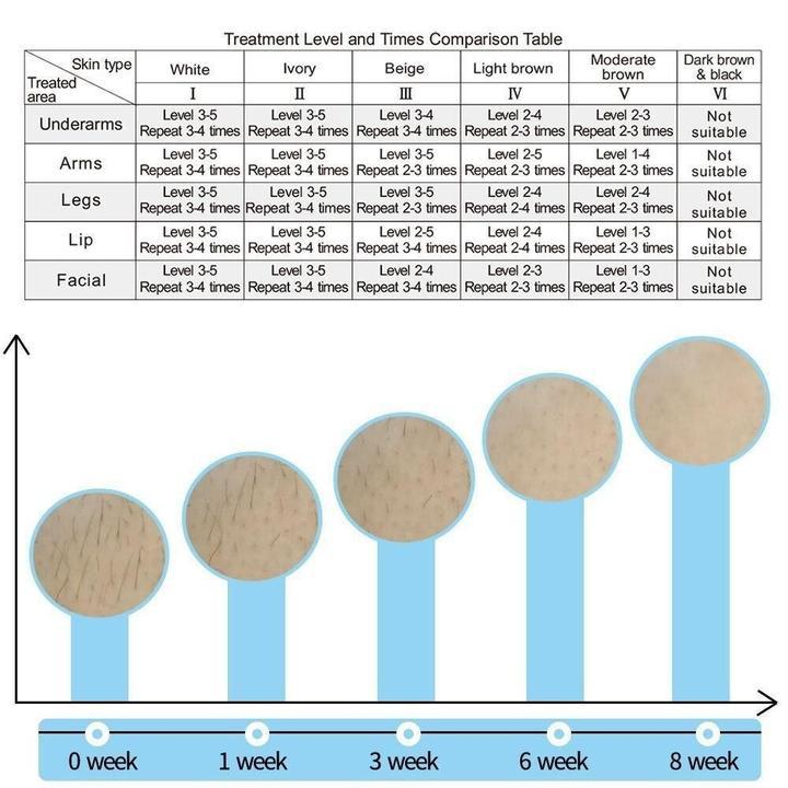 IPL Laser Hair Removal 2019! - WikiWii