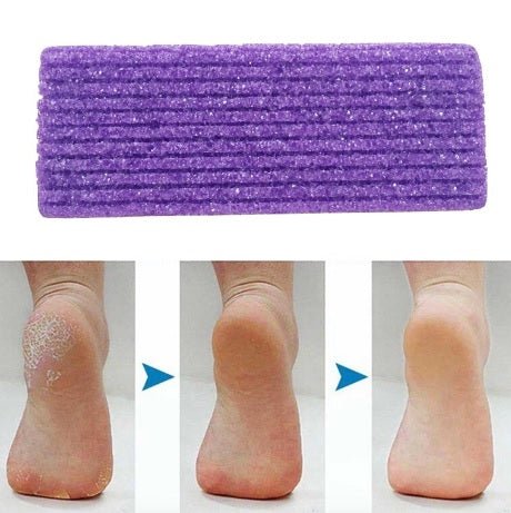 Foot Dead Skin Scrubber-2 Pcs - YOYOWIZZ